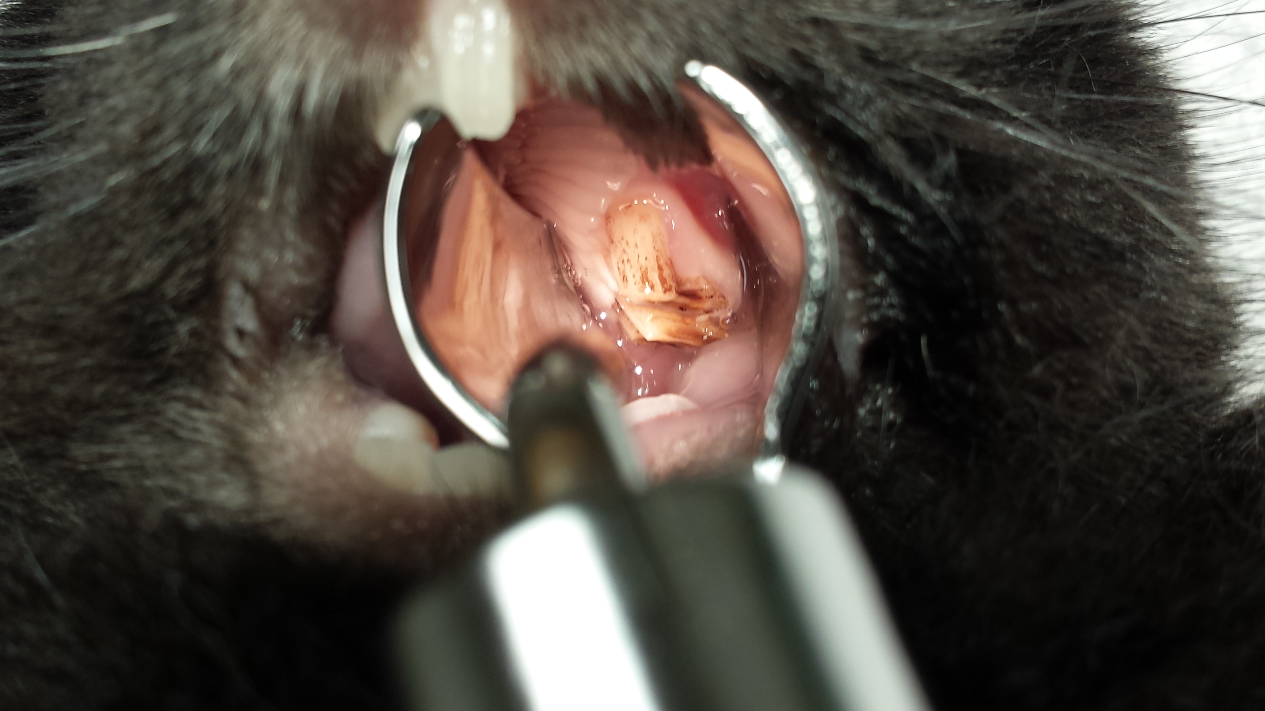 Teeth 1